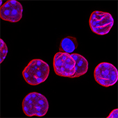 lamin in gloma stem cells